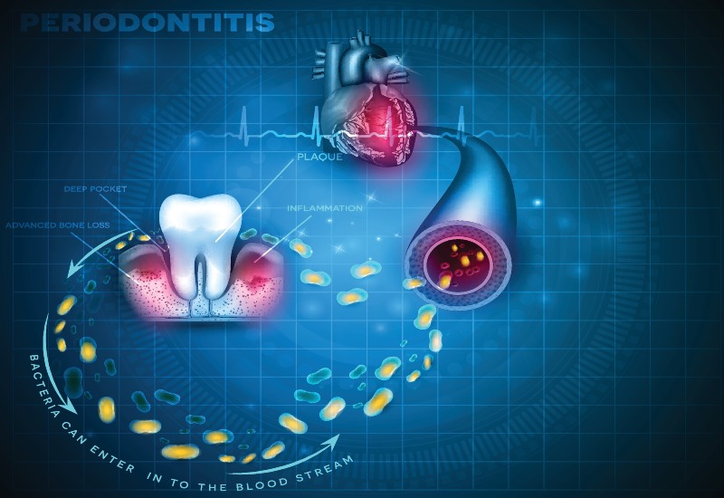 An infographic showing the link between gum health and heart disease in Millersburg, OH